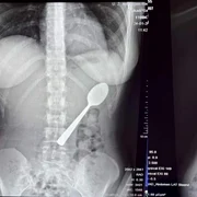 o femeie a inchitit o lingura jpg