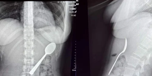 o femeie a inchitit o lingura jpg