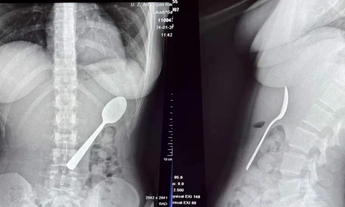 o femeie a inchitit o lingura jpg