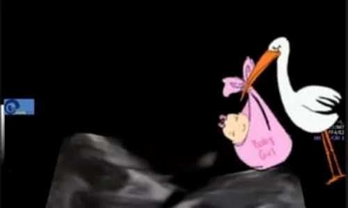 În aprilie a anunţat că sarcina cvadruplă a prins jpeg