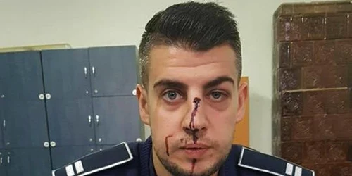 Poliţistul a fost lovit de un şofer nervos