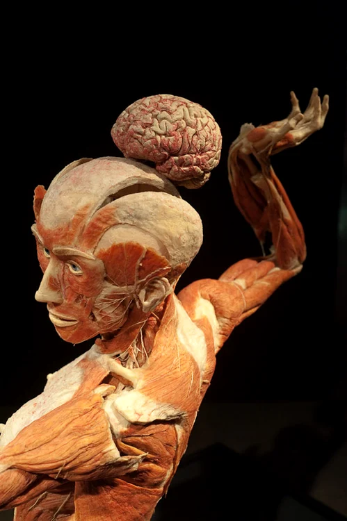 Plastinare jpeg