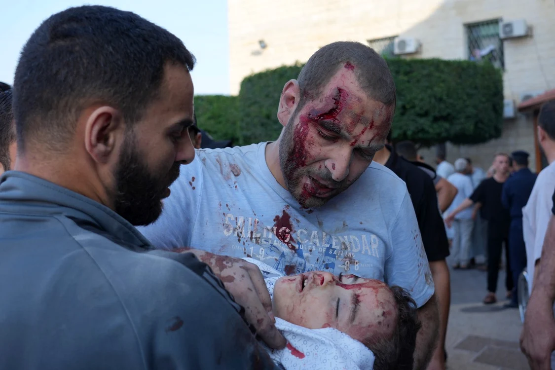 În Gaza, medicii nu au, uneori, nicio opţiune de a salva vieţi, decât amputarea. Foto Shutterstock