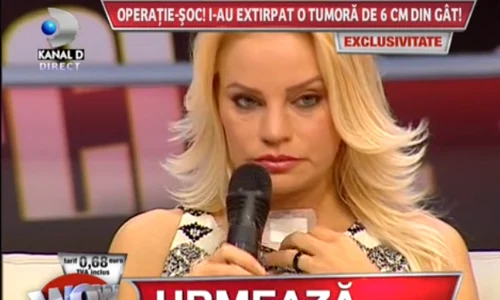 Mariana şi a arătat bandajul png