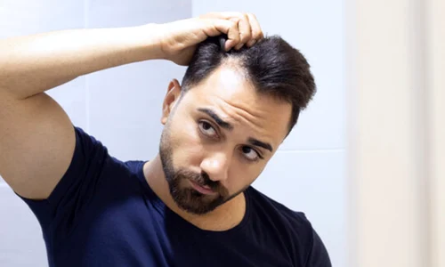 par cadere chelie adobestock jpg