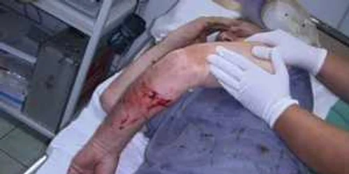 Victima are 53 de ani şi este din localitatea Huseni
