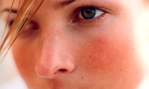 1 rozaceea 1 png png