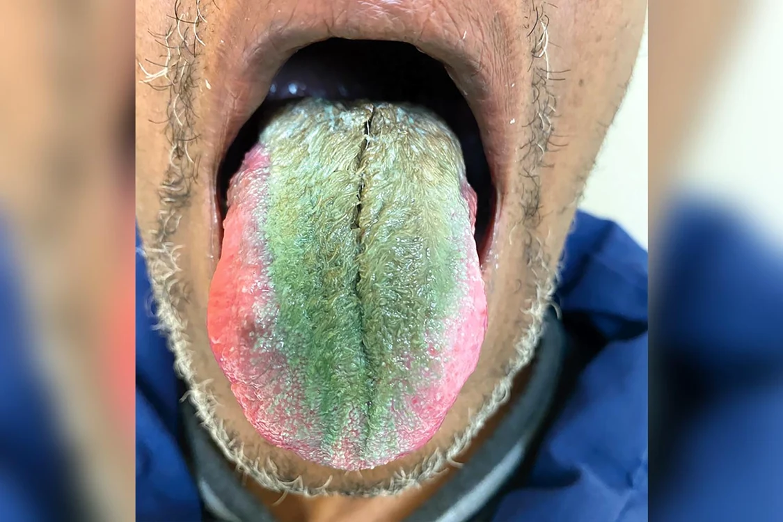 Foto: The New England Journal of Medicine