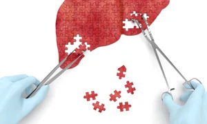 puzzle ficat 43692274 xxl jpeg