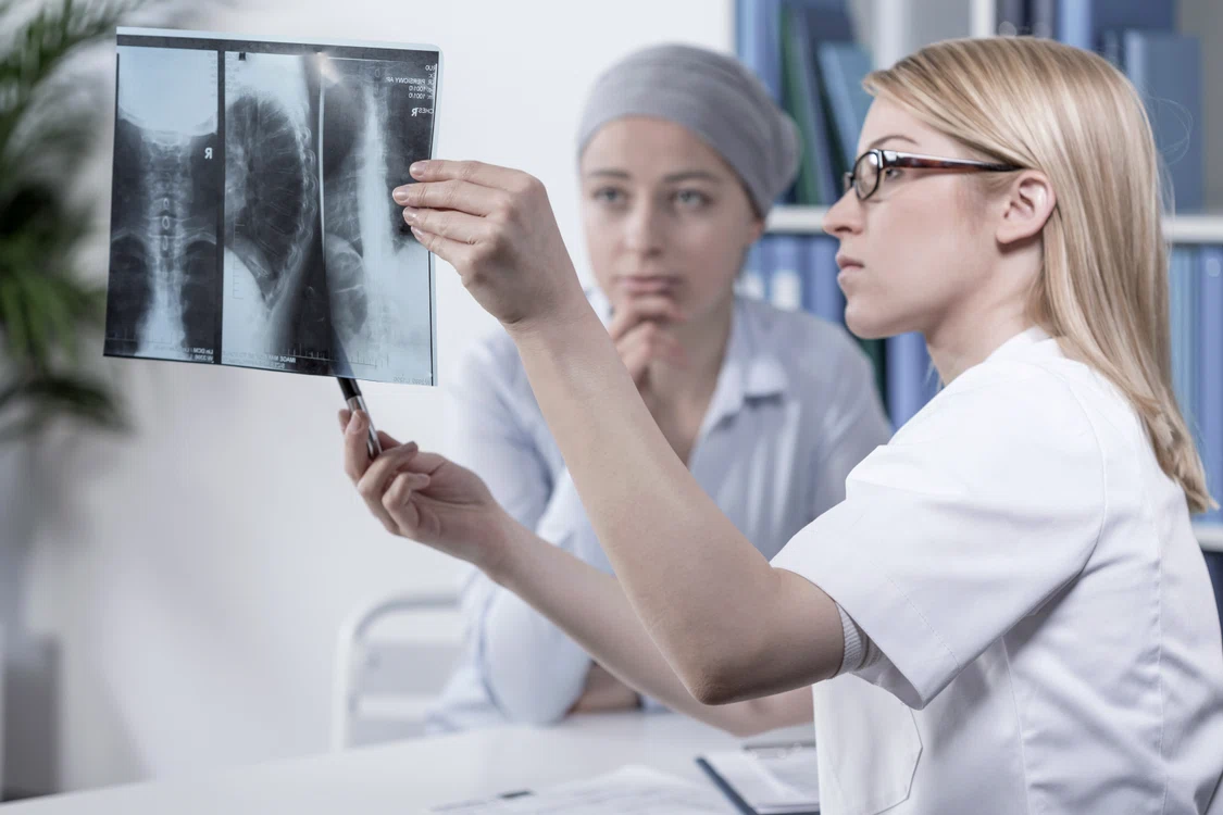 Cancerul pulmonar este cel mai agresiv dintre cancere