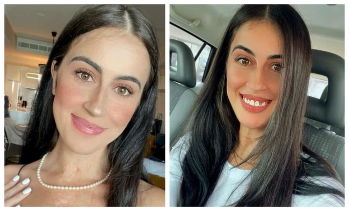 Femeia care și-a transportat propria inimă într-o pungă de plastic / Sursă foto: Colaj Instagram