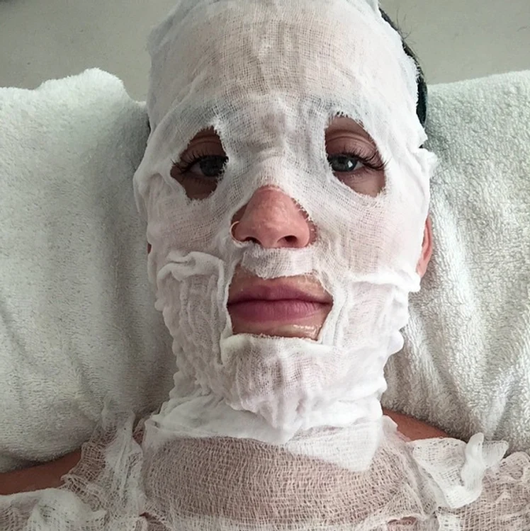 
    Katy Perry, bandajată pe o rețea socialăfoto: arhiva personală  