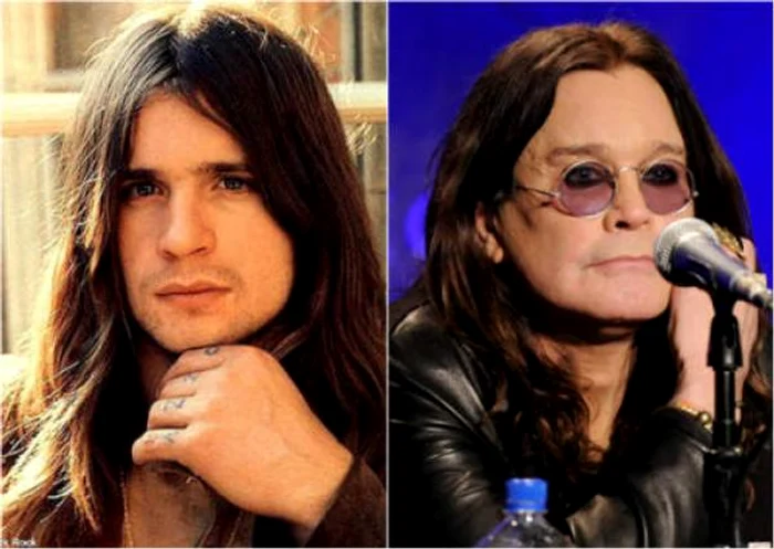 ozzy osbourne operatie estetica
