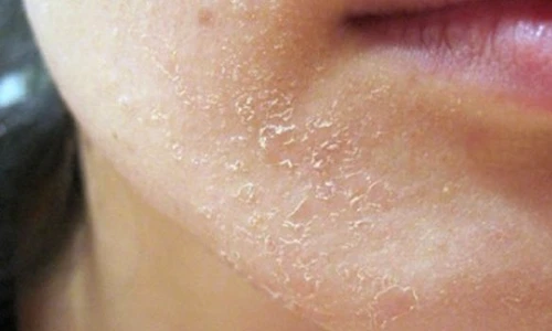 1 semnele pe care ti le transmite corpul cand este bolnav nu le mai ignora niciodata aztu jpg jpeg