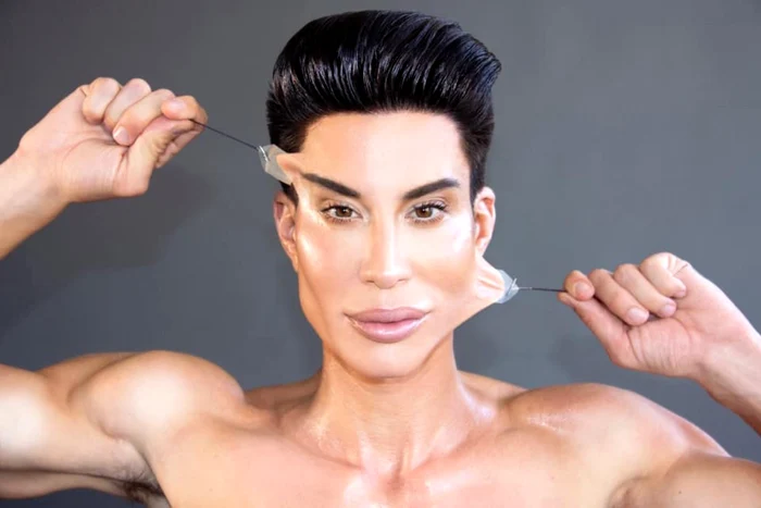 Justin Jedlica a făcut sute de operaţii estetice.