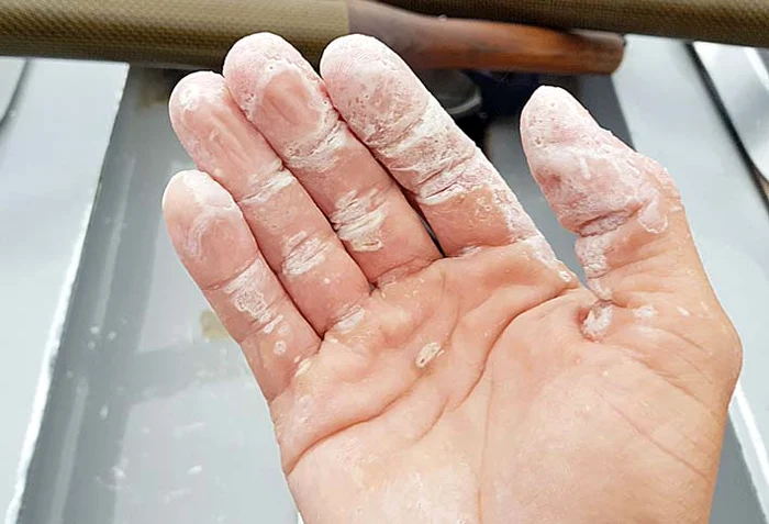 Aşa arătau palmele sale după ce a vâslit 38 de zile 