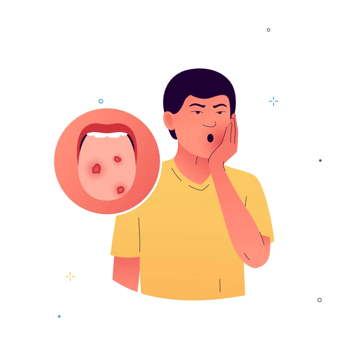 Chiar și o simplă pată pe limbă poate fi un simptom. FOTO: Shutterstock