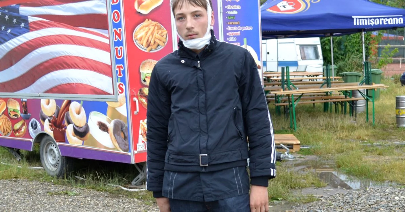 Marius Bogdan Pricop are nevoie de proteză specială pentru mandibulă