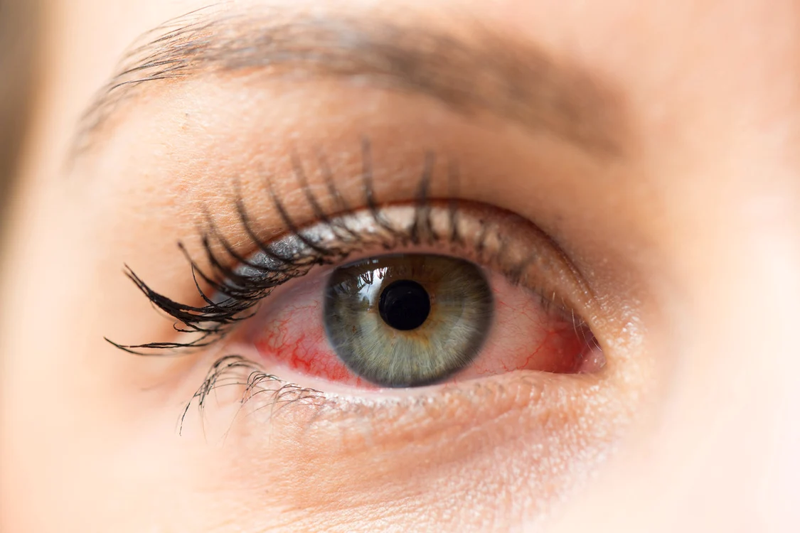 Sursa foto: Shutterstock
