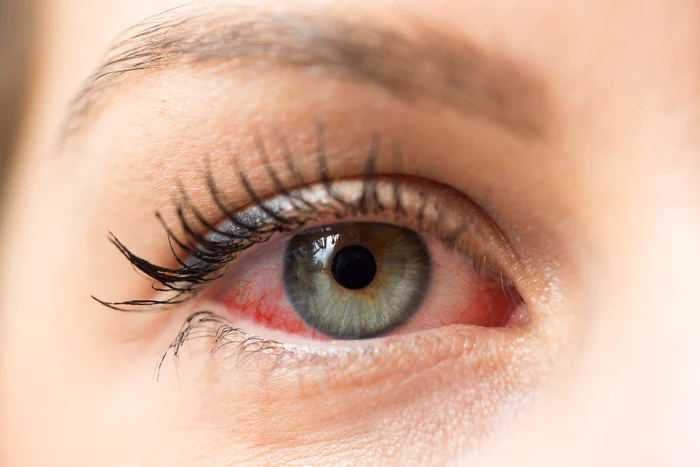 Sursa foto: Shutterstock