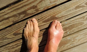 feet 174216 1280 jpg