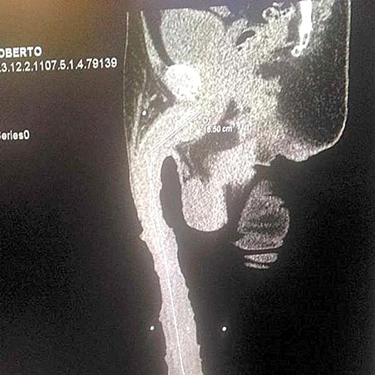 Radiografia a arătat că bărbăţia mexicanului e naturală