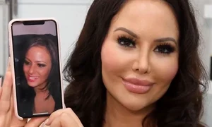 Așa arăta tânăra înainte de operațiile estetice jpeg