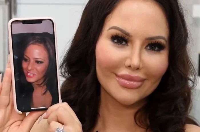 Așa arăta tânăra înainte de operațiile estetice