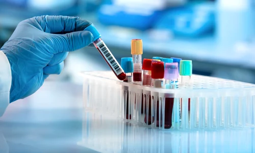 Analize de sange FOTO Shutterstock jpg