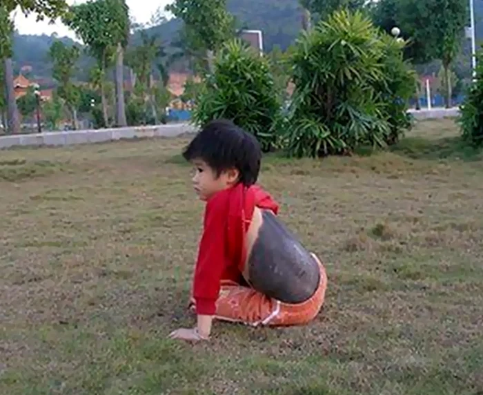 Părul s-a extins pe mai mult de jumătate din corp