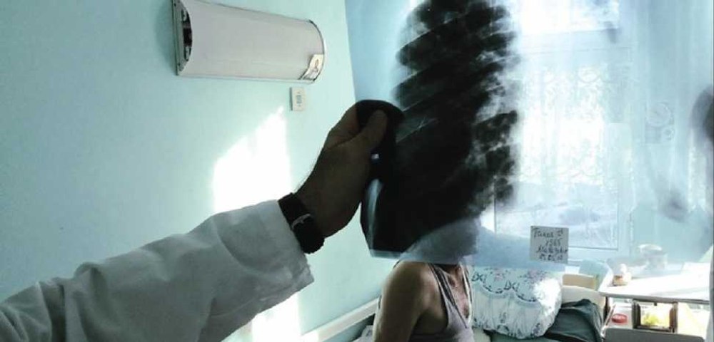 Crește periculos numărul cazurilor de tuberculoză la copii