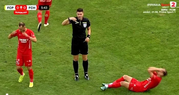 Dragoș Iancu a suferit o fractură deschisă la meciul cu petrolul. Captură PrimaSport 