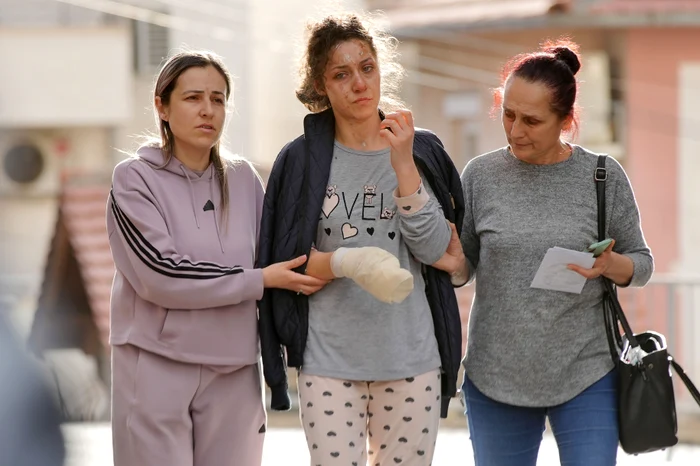 Supraviețuitorii s-au ales cu arsuri grave (Foto: GettyImages)