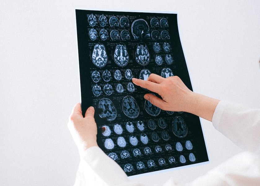 Cele 4 vârste la care creierul nostru se schimbă. Adolescența neuronală durează până la 32 de ani
