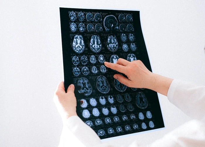 Ccreierul își reorganizează constant conexiunile neuronale. FOTO: Pexels