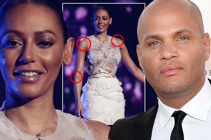 Melanie Brown este căsătorită din 2007 cu Stephen BelafonteFoto: Mirror