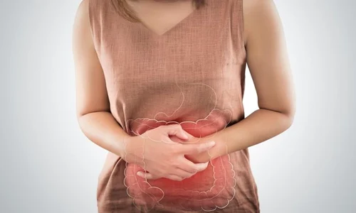 1 colon iritabil jpg jpeg