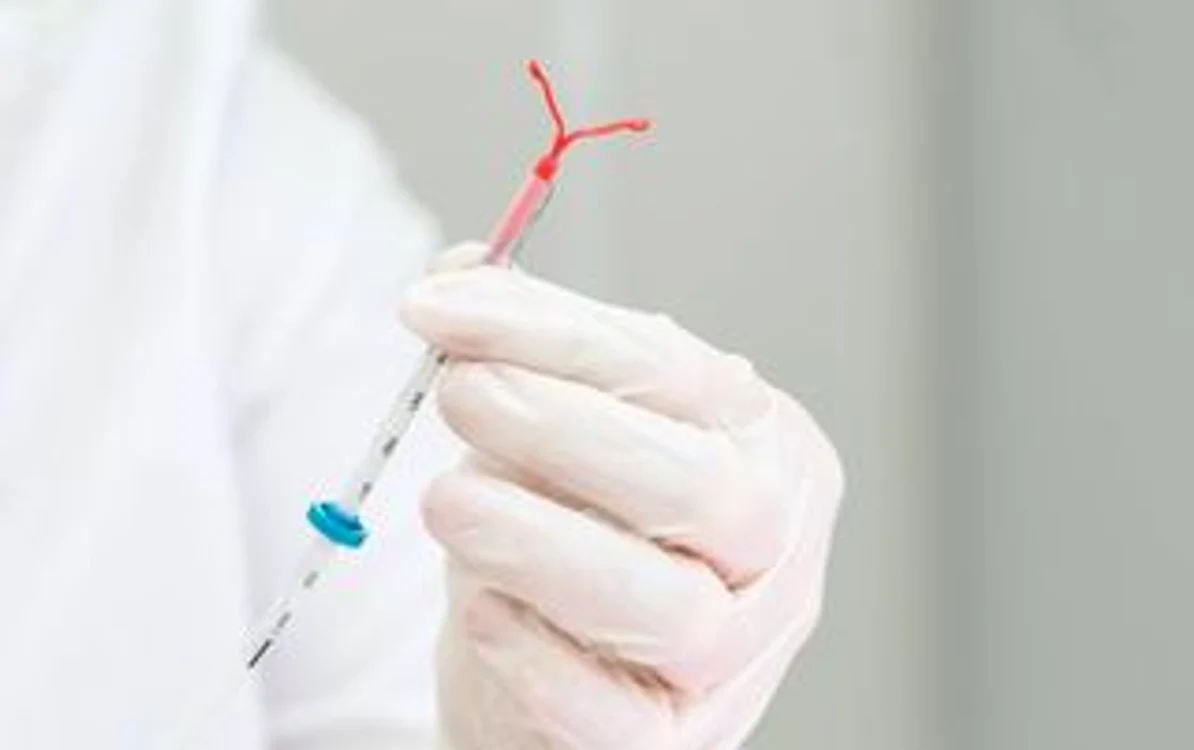 
    Steriletul sau dispozitivul intrauterin (DIU) este cea mai indicată metodă contraceptivă pentru femei, după ce au devenit mame, în scopul împiedicării apariției unei alte sarcinifoto: shutterstock  