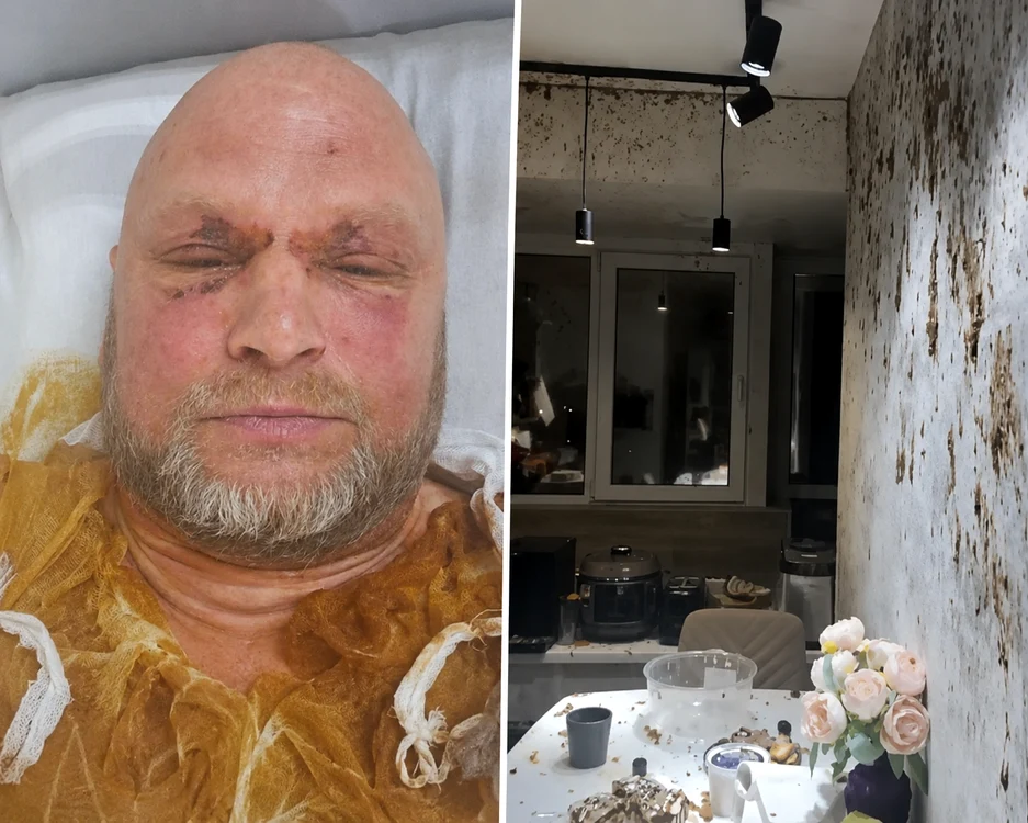 Alexander Lutovin în spital și casa lui după explozie / foto: social media 