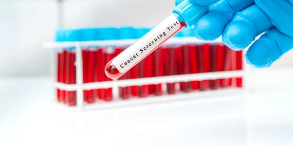 test cancer