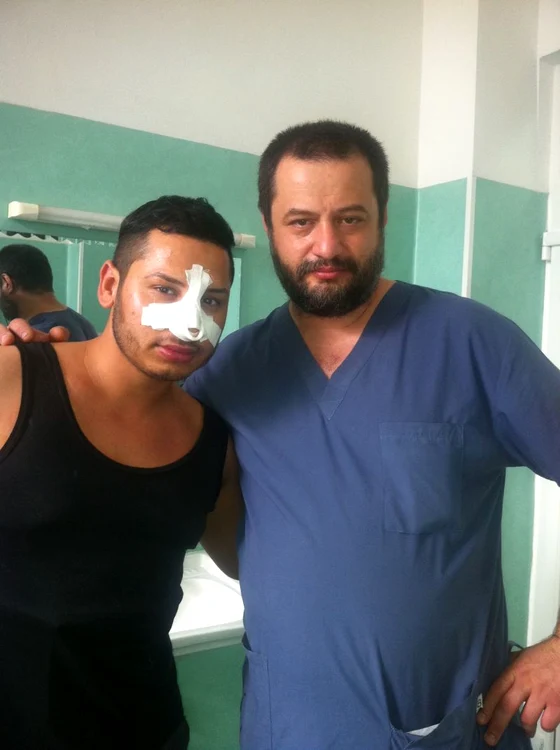 
    Adrian Pescariu aşteaptă cu nerăbdare să-şi vadă noul nas  