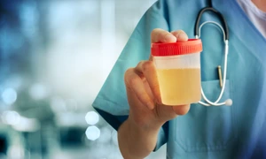 urina_shutterstock 275331890 jpg