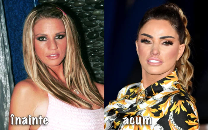 Victoria Beckham și-a stricat chipul cu o operație la nas, față de cum arăta în mod naturalfoto: GettyImages