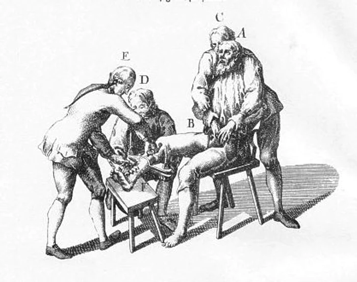 Gheata se folosea pentru interogatorii