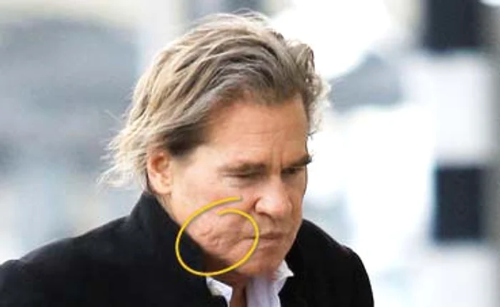 
    Pe obraz se  pot vedea două  cicatrici urâteFoto: Xposure  