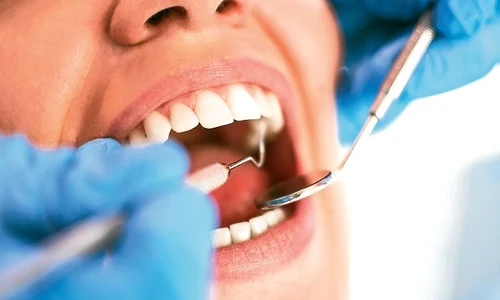 1 tratarea parodontozei jpg jpeg