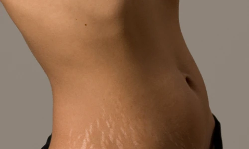 1 70094 original jpg jpeg