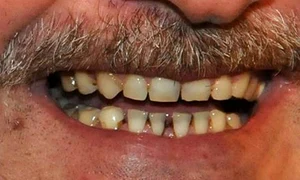 Lui Dragnea îi e frică de dentist jpeg