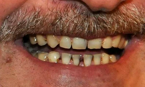 Lui Dragnea îi e frică de dentist jpeg