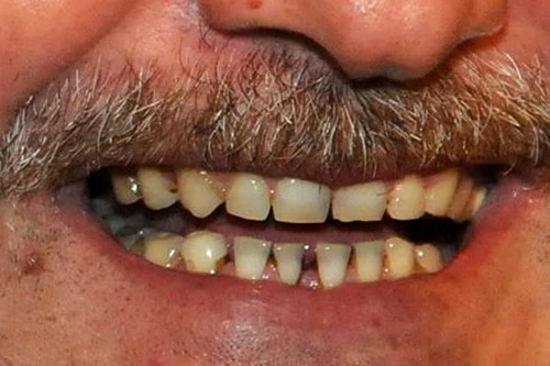 Lui Dragnea îi e frică de dentist jpeg